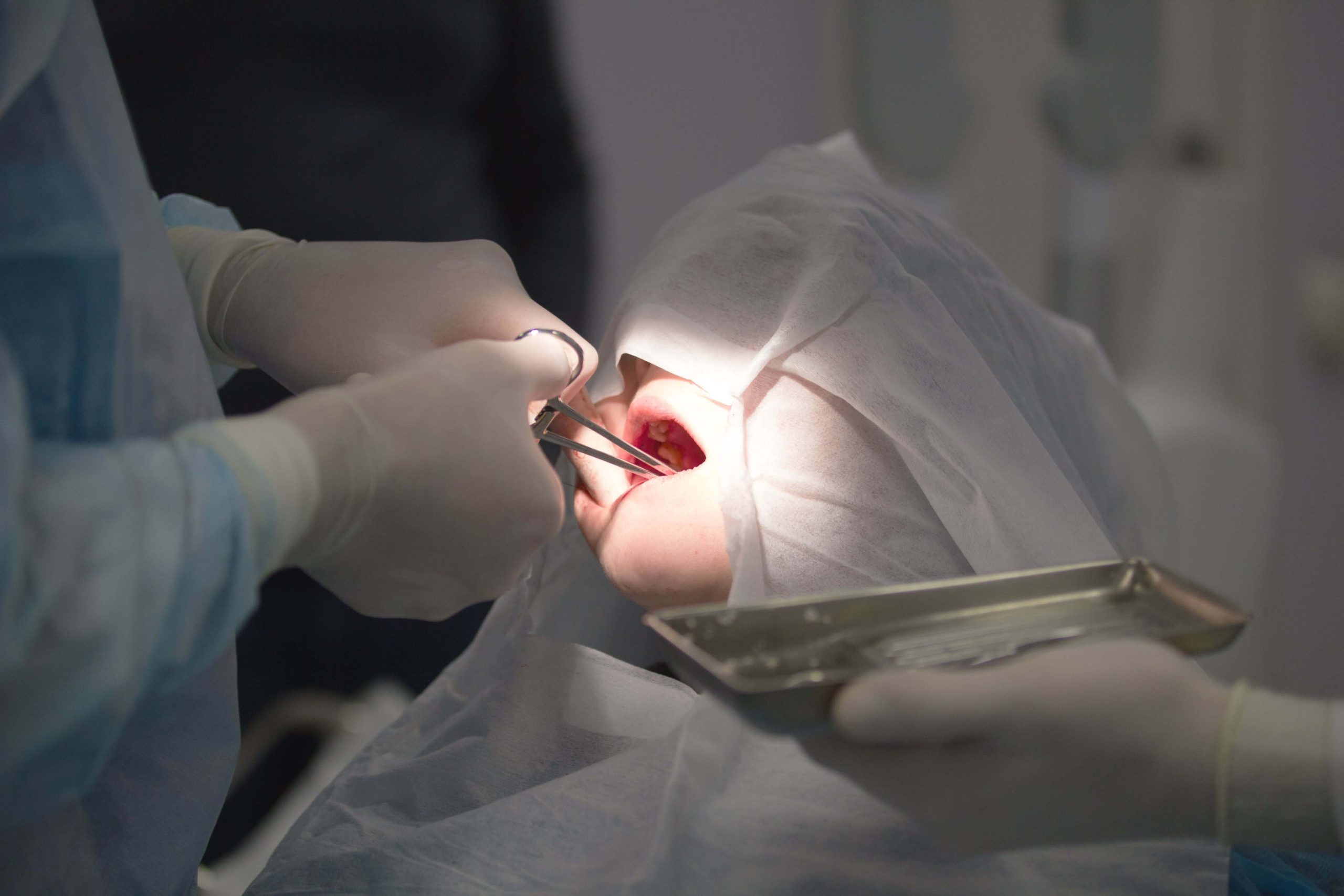 Dental Extraction in Rossmoyne Book Online Now Affordable Dental Care, Friendly & Professional Environment