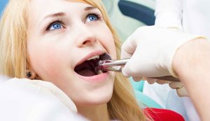 Read more about the article Painless Dental Extraction in Riverton: Tips from the Experts