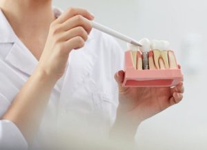 Read more about the article Affordable Dental Implant: Why does Every Dentist Say Something Different in Brentwood?