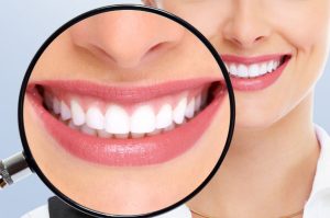 Read more about the article Benefits of Professional Teeth Whitening: Can Yellow Teeth Become White Again?