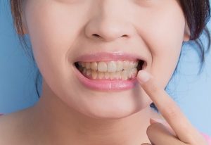 Read more about the article Best Dentist for Gum Disease: How Long do Teeth Last without Brushing?