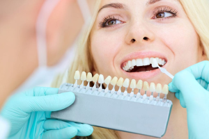 Read more about the article Cosmetic Dentistry Options in Brentwood: What You Need to Know