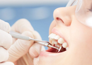 Read more about the article What Should You Expect During and After a Wisdom Teeth Removal Procedure?