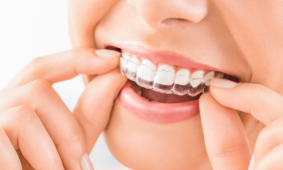 Do You Lose Weight on Invisalign?