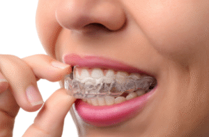 Read more about the article Invisalign Dentist in Shelley: What is the 22 Hour Rule for Invisalign?