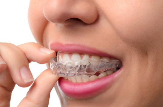 Invisalign Dentist