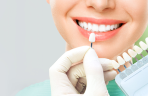Read more about the article Cosmetic Dentistry Mount Pleasant: How Long Do Results Last?