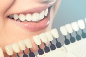 Read more about the article Top Cosmetic Dentistry Trends in Mount Pleasant | Bull Creek Dental