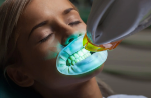 Read more about the article Why Professional Teeth Whitening in Applecross Is Worth It