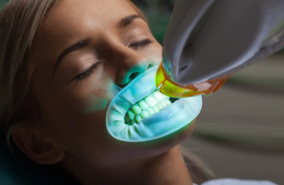 Why Professional Teeth Whitening in Applecross Is Worth It