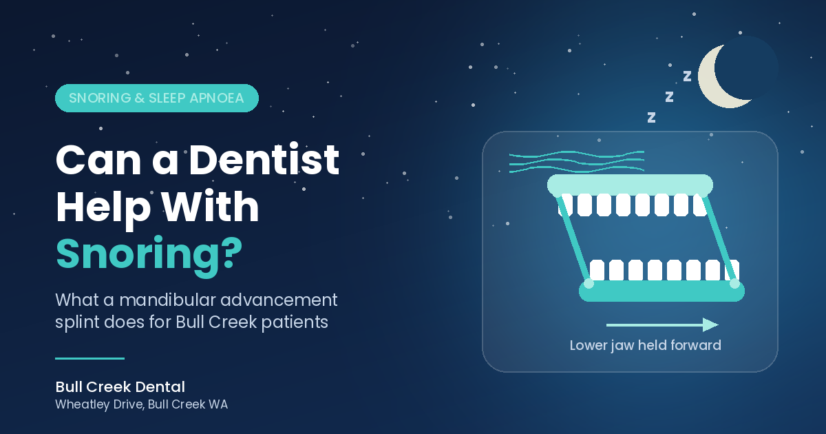bull-creek-dental-snoring-mandibular-advancement-splint