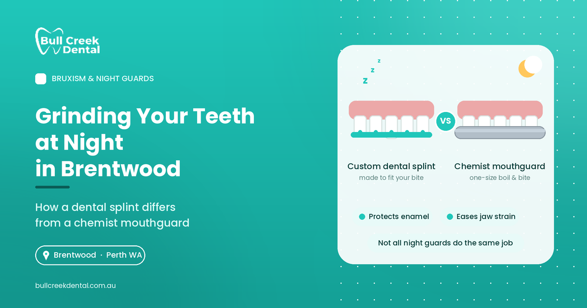Dental Splints Brentwood | Custom Splint vs Chemist Guard