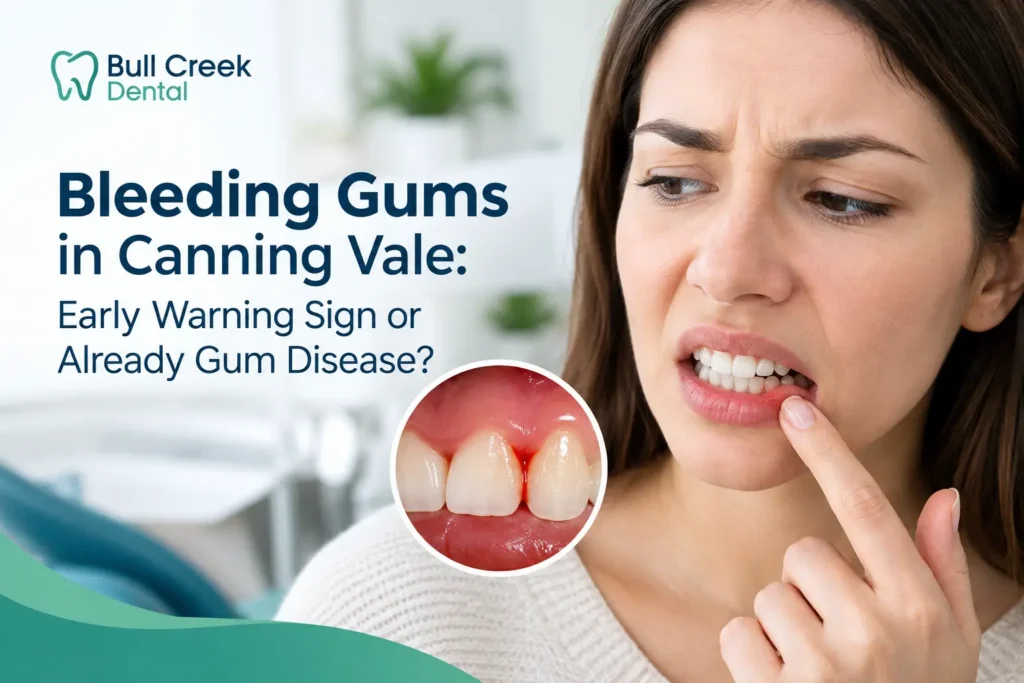 Bleeding Gums in Canning Vale: Early Warning Sign or Already Gum Disease?